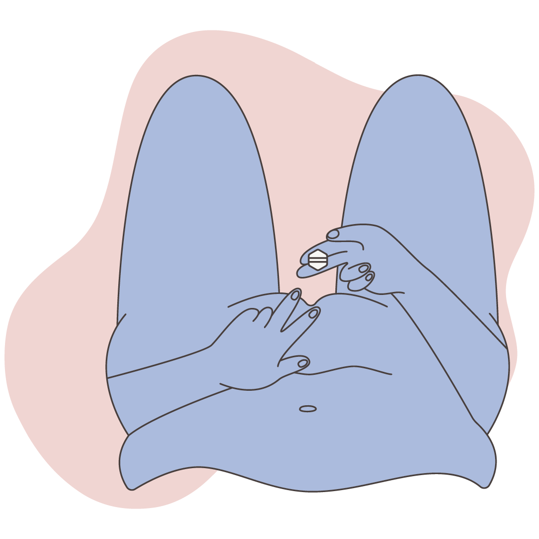 Illustration of vaginal administration of misoprostol