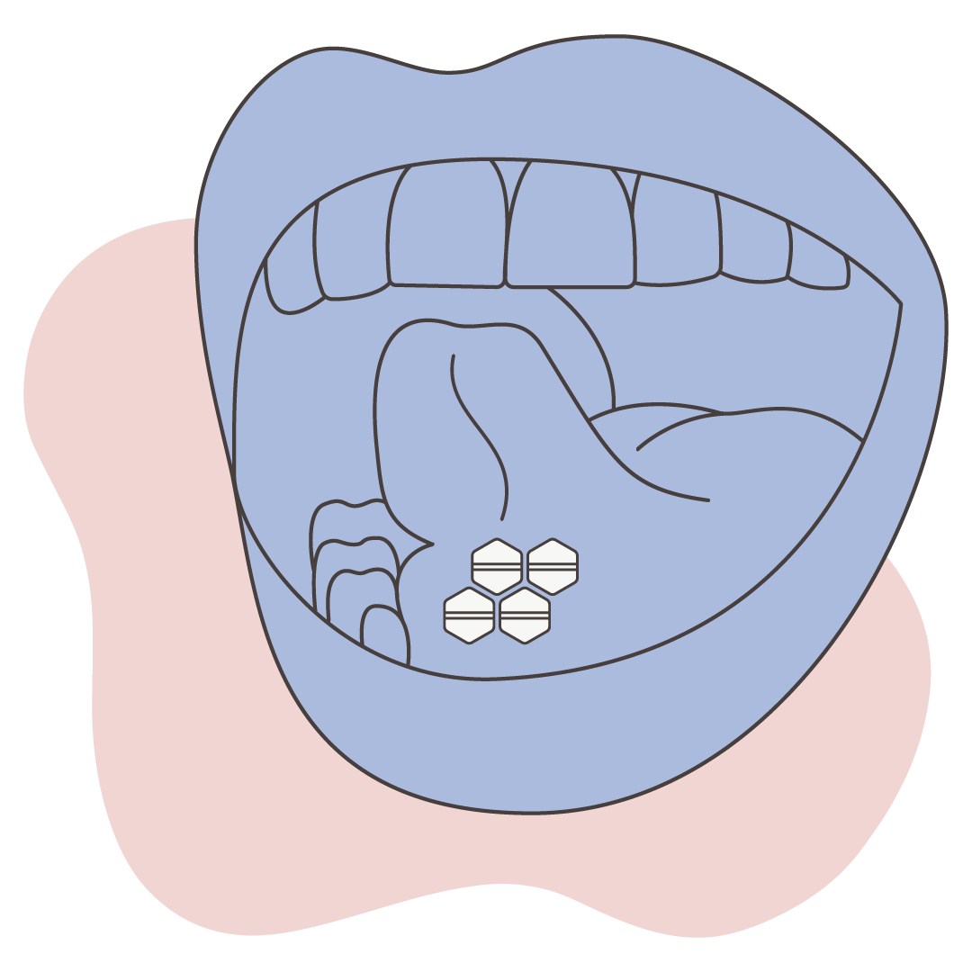 Illustration of sublingual administration of misoprostol